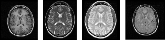 resonancia magnetica cerebral contraste